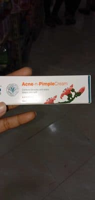 Himalaya Acne n pimple cream